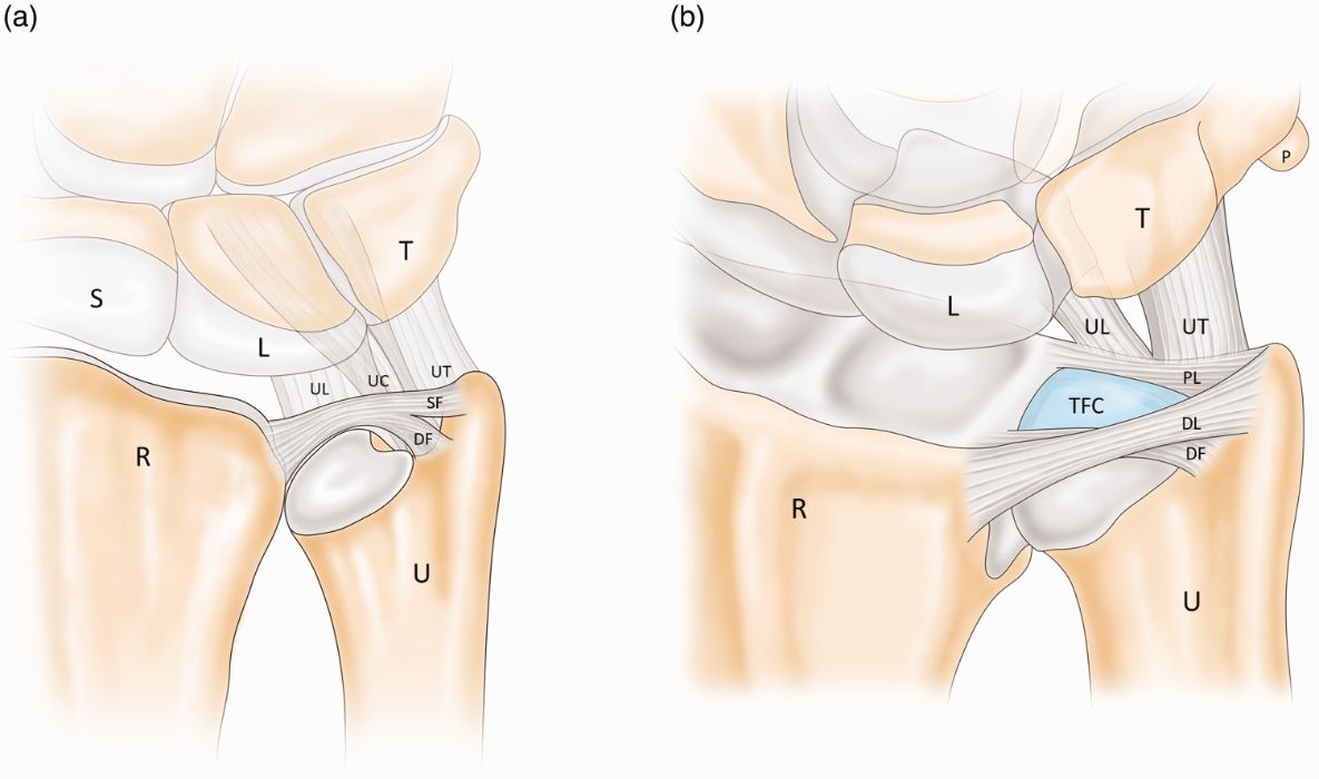 Diagram of a normal triangular fibrocartilage complex (TFCC) in the wrist