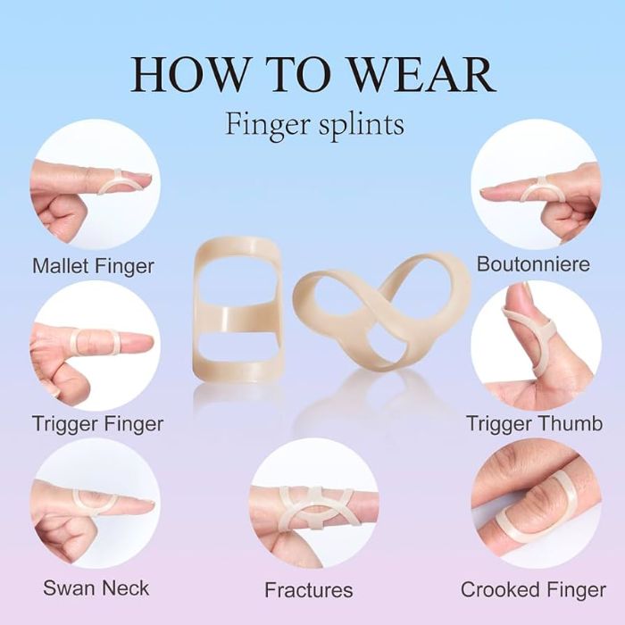 Splints for hand osteoarthritis