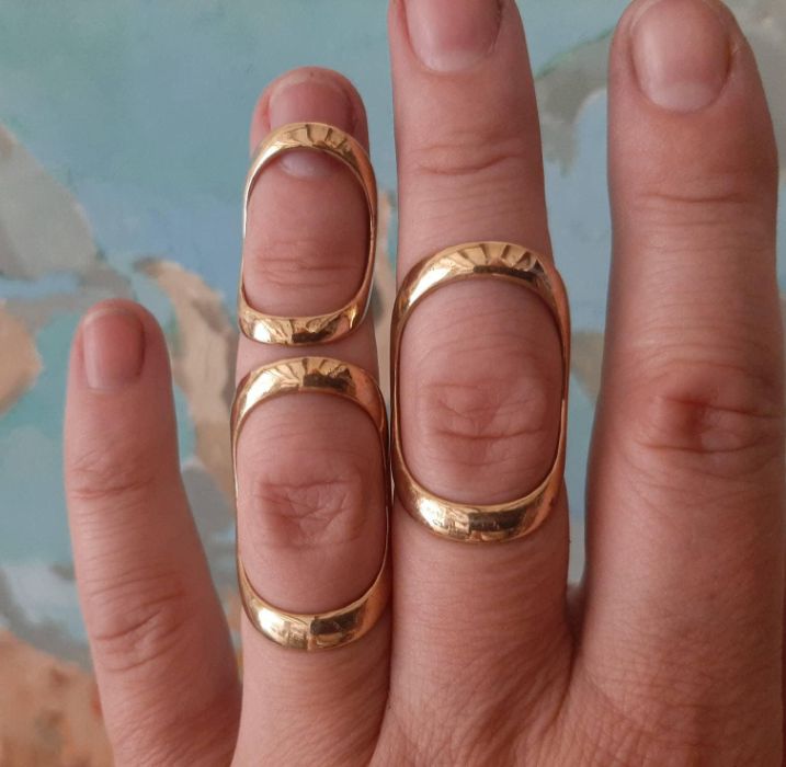 Jewellery-style ring splints for finger arthritis