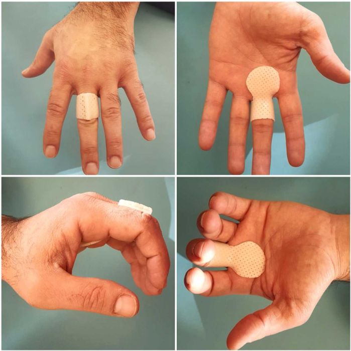 Trigger finger splint