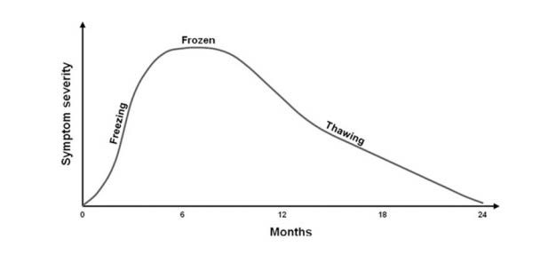 Graph of frozen shoulder showing pain and stiffness over time