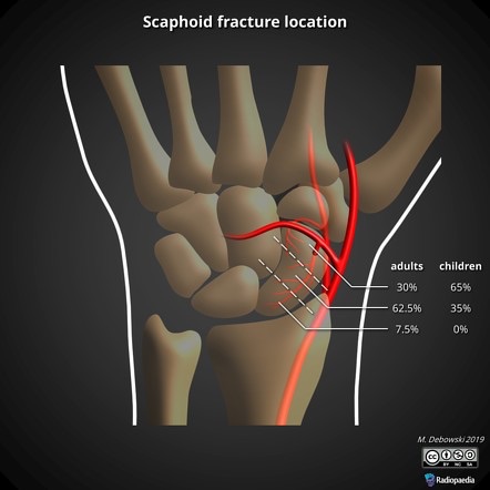 Blood supply to the scaphoid entering mainly at the thumb end of the bone