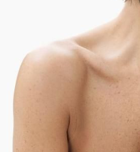 Shoulder