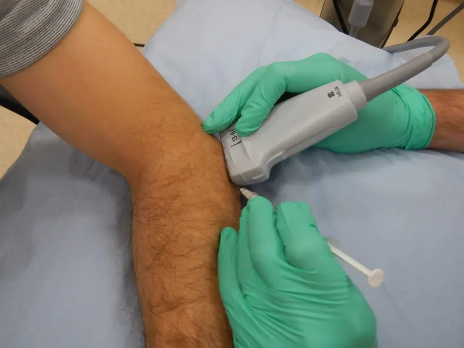 Ultrasound-guided injection into the outer elbow for tennis elbow