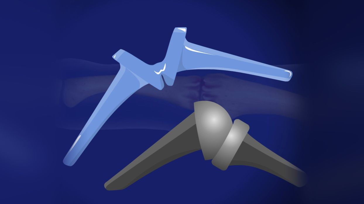 Artificial PIP finger joint replacement