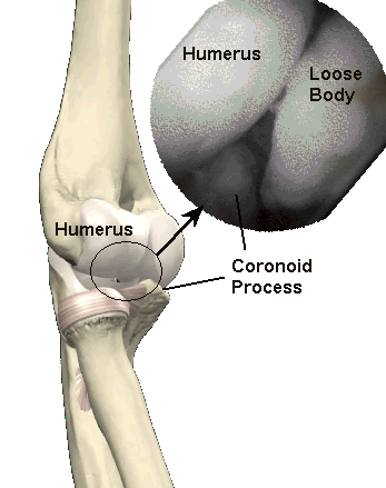 View inside the elbow joint during keyhole arthroscopy