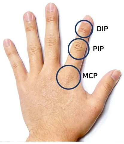 The three finger joints: DIP, PIP and MCP