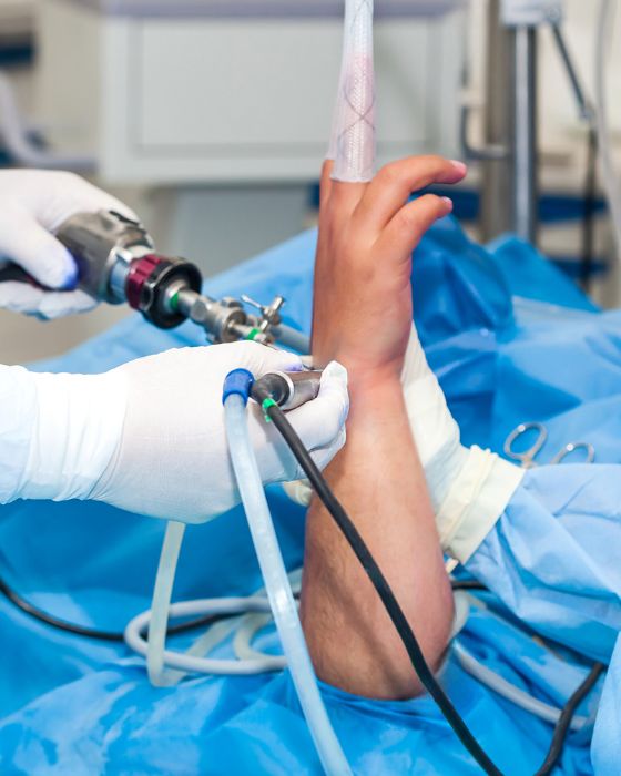 Wrist arthroscopy set-up in theatre